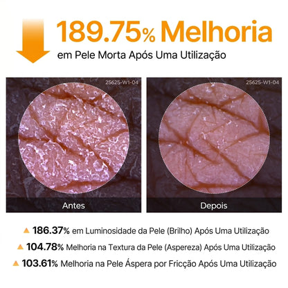 Spray Corporal Esfoliante com Ácido Kójico e Cúrcuma - GOLDEN PEEL™